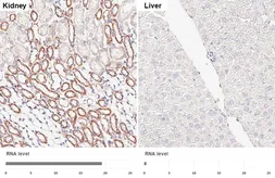 Anti-Hexokinase 1 antibody [HL6617] used in IHC (Paraffin sections) (IHC-P). GTX649317