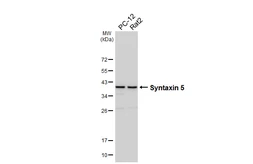 Anti-Syntaxin 5 antibody [HL6629] used in Western Blot (WB). GTX649329