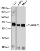 Anti-THUMPD3 antibody used in Western Blot (WB). GTX64933
