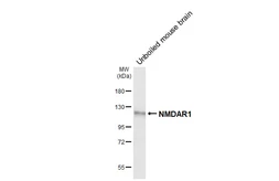 Anti-NMDAR1 antibody [GT435] used in Western Blot (WB). GTX649344