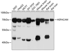 Anti-HEPACAM antibody used in Western Blot (WB). GTX64936