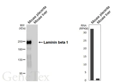 Anti-Laminin beta 1 antibody [HL6655] used in Western Blot (WB). GTX649364