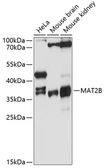 Anti-MAT2B antibody used in Western Blot (WB). GTX64937