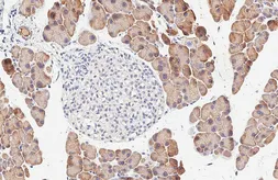 Anti-CPA1 antibody [HL6671] used in IHC (Paraffin sections) (IHC-P). GTX649380