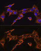 Anti-BDKRB2 antibody used in Immunocytochemistry/ Immunofluorescence (ICC/IF). GTX64939