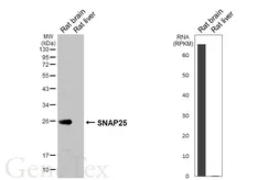 Anti-SNAP25 antibody [HL6681] used in Western Blot (WB). GTX649392