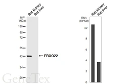 Anti-FBXO22 antibody [HL6682] used in Western Blot (WB). GTX649393