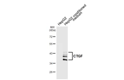 Anti-CTGF antibody [HL6685] used in Western Blot (WB). GTX649396