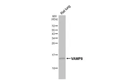 Anti-VAMP8 antibody [HL6688] used in Western Blot (WB). GTX649399