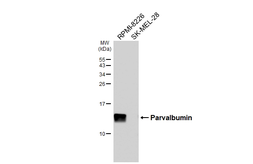 Anti-Parvalbumin antibody [HL6691] used in Western Blot (WB). GTX649402