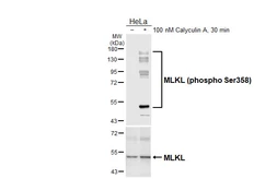 Anti-MLKL (phospho Ser358) antibody [HL6693] used in Western Blot (WB). GTX649404