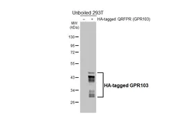 Anti-GPR103 antibody [HL6698] used in Western Blot (WB). GTX649409