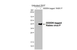 Anti-Rabies virus P antibody [HL6701] used in Western Blot (WB). GTX649412