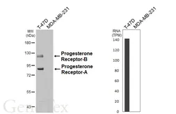Anti-Progesterone Receptor antibody [HL6704] used in Western Blot (WB). GTX649415