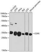 Anti-COPE antibody used in Western Blot (WB). GTX64942