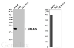 Anti-CD3 delta antibody [GT436] used in Western Blot (WB). GTX649443