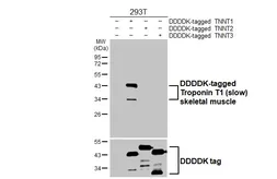 Anti-Troponin T1 (slow) skeletal muscle antibody [HL6725] used in Western Blot (WB). GTX649448