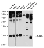 Anti-SNAPIN antibody used in Western Blot (WB). GTX64946