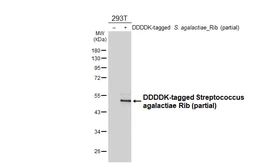 Anti-Streptococcus agalactiae Rib antibody [HL6740] used in Western Blot (WB). GTX649463