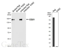 Anti-CD21 antibody [HL6742] used in Western Blot (WB). GTX649465