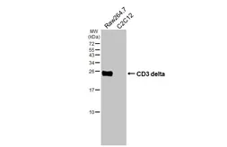 Anti-CD3 delta antibody [HL6744] used in Western Blot (WB). GTX649467
