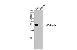 Anti-CD3 delta antibody [HL6744] used in Western Blot (WB). GTX649467