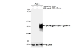 Anti-EGFR (phospho Tyr1068) antibody [HL6747] used in Western Blot (WB). GTX649470
