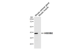 Anti-HSD3B2 antibody [HL6752] used in Western Blot (WB). GTX649475