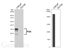 Anti-PSA antibody [HL6753] used in Western Blot (WB). GTX649476
