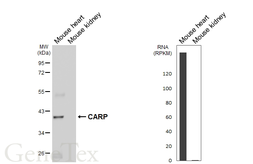 Anti-CARP antibody [GT437] used in Western Blot (WB). GTX649486