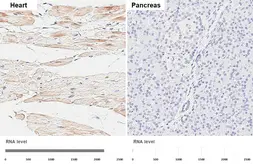 Anti-CARP antibody [GT437] used in IHC (Paraffin sections) (IHC-P). GTX649486