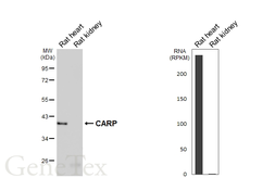 Anti-CARP antibody [GT438] used in Western Blot (WB). GTX649487