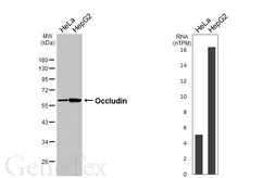 Anti-Occludin antibody [GT441] used in Western Blot (WB). GTX649490
