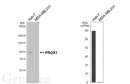 Anti-PROX1 antibody [HL6773] used in Western Blot (WB). GTX649504