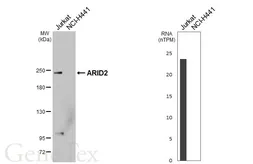 Anti-ARID2 antibody [HL6776] used in Western Blot (WB). GTX649507