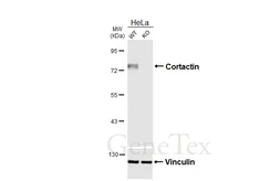 Anti-Cortactin antibody [HL6795] used in Western Blot (WB). GTX649526