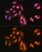 Anti-KAP3 antibody used in Immunocytochemistry/ Immunofluorescence (ICC/IF). GTX64954