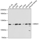 Anti-SRRM1 antibody used in Western Blot (WB). GTX64955