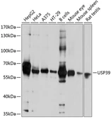 Anti-USP39 antibody used in Western Blot (WB). GTX64959