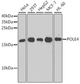 Anti-POLE4 antibody used in Western Blot (WB). GTX64960