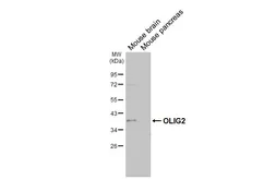 Anti-OLIG2 antibody [HL6811] used in Western Blot (WB). GTX649625