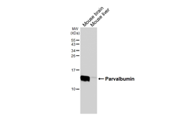 Anti-Parvalbumin antibody [HL6816] used in Western Blot (WB). GTX649630