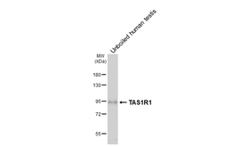 Anti-TAS1R1 antibody [HL6823] used in Western Blot (WB). GTX649637