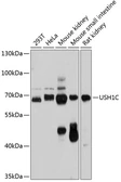 Anti-USH1C antibody used in Western Blot (WB). GTX64964