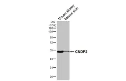 Anti-CNDP2 antibody [HL6833] used in Western Blot (WB). GTX649647