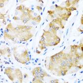 Anti-Activin Receptor Type IC antibody used in IHC (Paraffin sections) (IHC-P). GTX64969