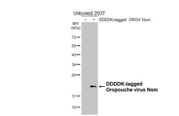Anti-Oropouche virus Nsm antibody [HL6855] used in Western Blot (WB). GTX649699