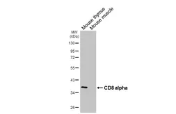 Anti-CD8 alpha antibody [HL6867] used in Western Blot (WB). GTX649711
