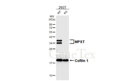 Anti-MPST antibody [HL6870] used in Western Blot (WB). GTX649714
