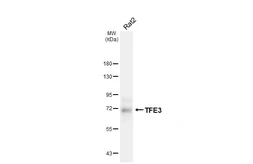 Anti-TFE3 antibody [HL6873] used in Western Blot (WB). GTX649717
